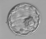 胚盤胞期