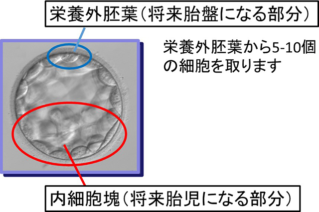 胚生検図